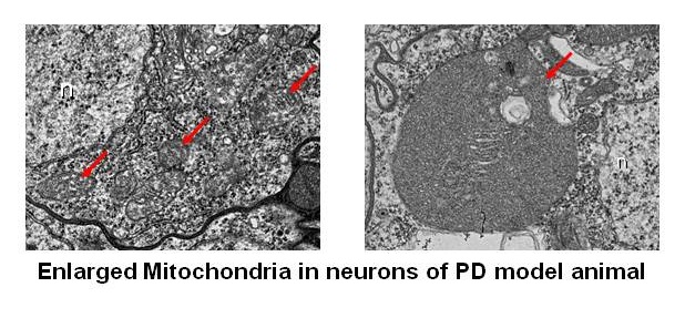 Cellular basis of various neurodegenerative diseases (Parkinson's disease, Alzheimer's disease, ALS, etc)
